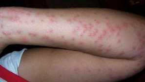 Claps: намерете и унищожете